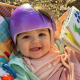 Georgia’s Clubfoot Helmet Story Image