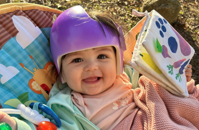 Georgia’s Clubfoot Helmet Story Image