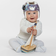 baby in cranial helmet for plagiocephaly treatment