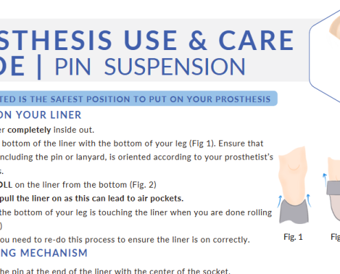 Prothesis Use & Care Guide Pin Suspension