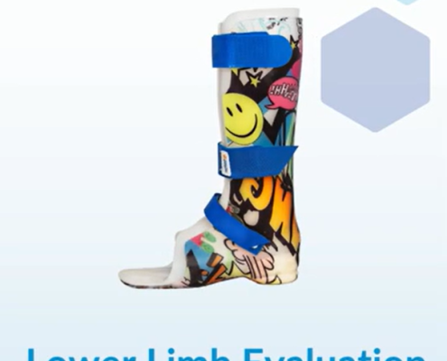 What to expect in your lower limb evaluation