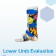 What to expect in your lower limb evaluation