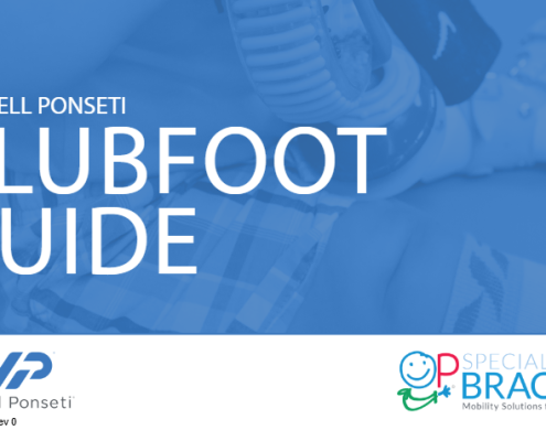 mitchell ponset clubfoot guide